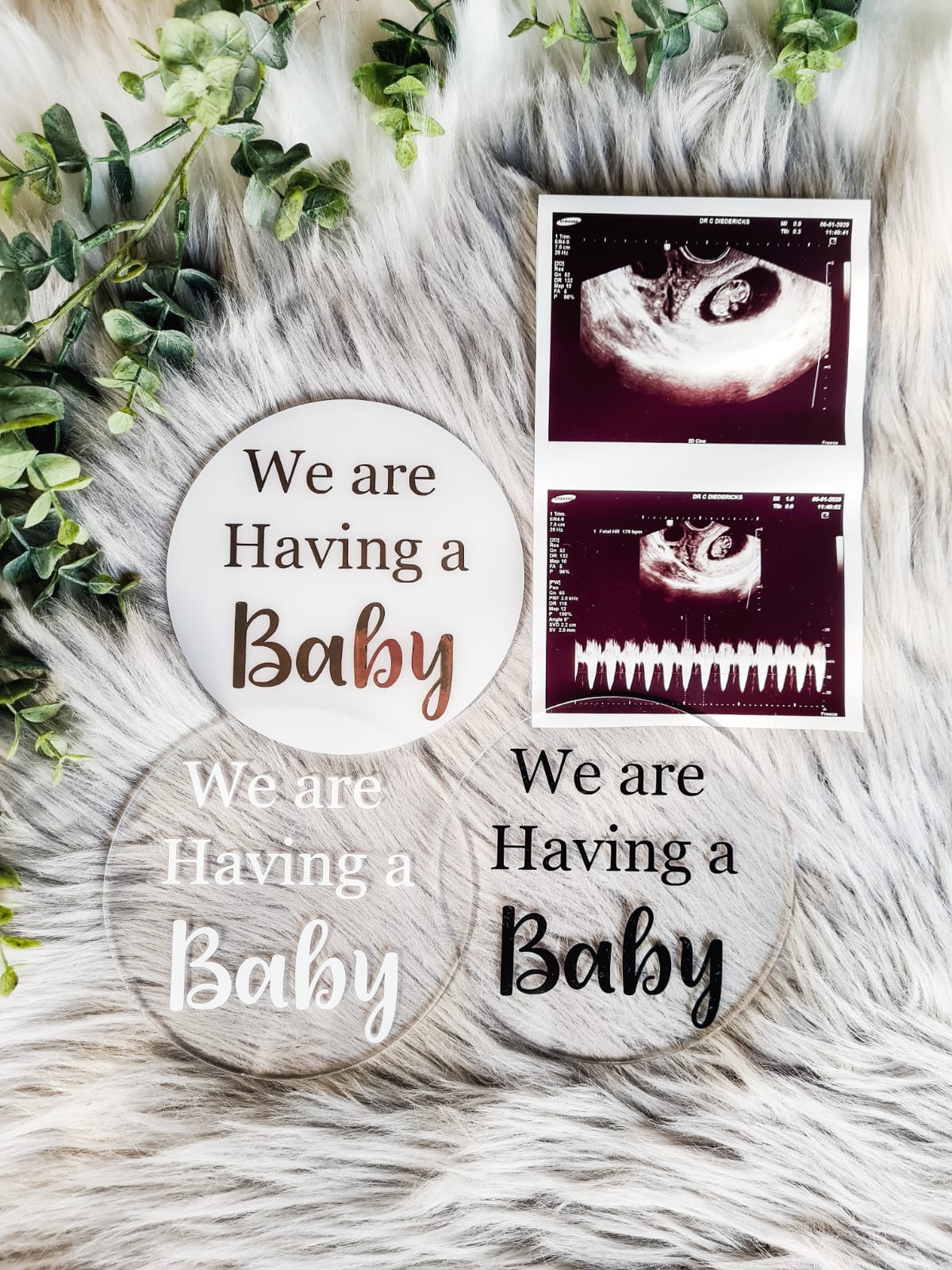Pregnancy milestone set